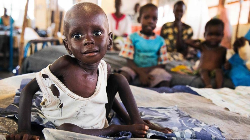 Millions face hunger pangs after WFP suspends humanitarian aid in South Sudan